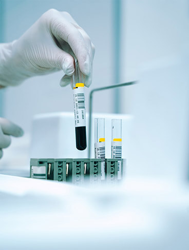 Creatinine Fluid Test